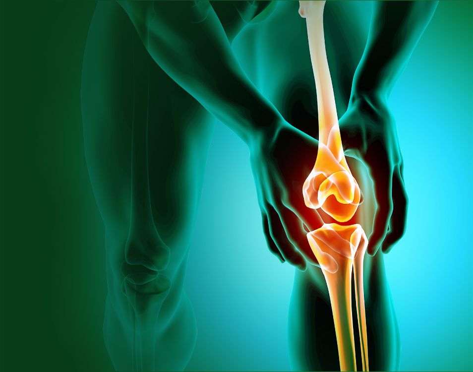 11 Punca Sakit Lutut, Rawat Cepat Sebelum Jadi Lebih Kronik & Makin Stress!