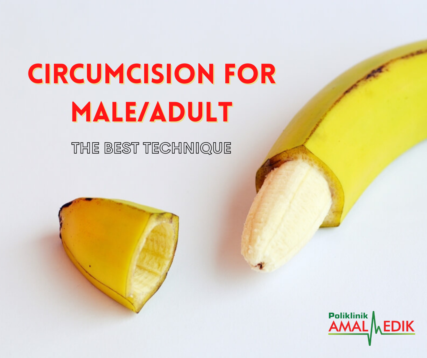 Circumcision For Male/Adult – The Best Technique