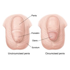 Foreskin (Prepuce): Purpose, Retraction, Hygiene & Care