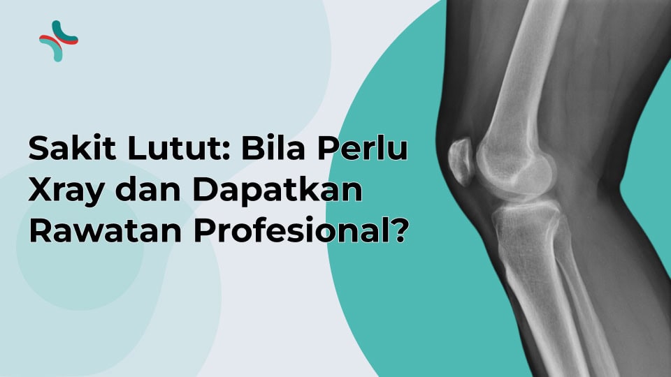 Sakit Lutut: Bila Perlu Xray Lutut dan Dapatkan Rawatan Profesional?